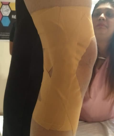 Kinesio taping therapy